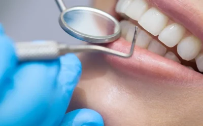 Implants dentaires au Luxembourg : le processus complet expliqué par le Dr. Ana Figueiredo