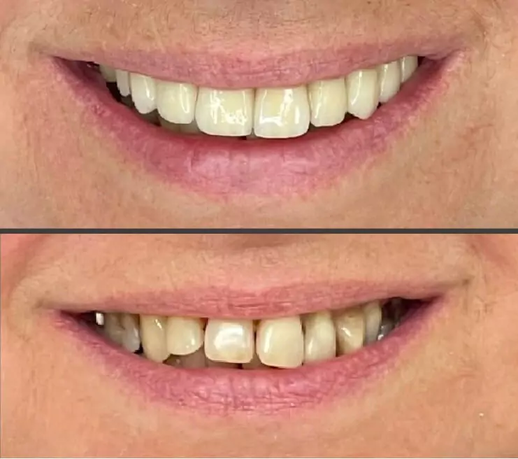 Dentiste au Luxembourg : des soins dentaires modernes Dentiste au Luxembourg : des soins dentaires modernes
