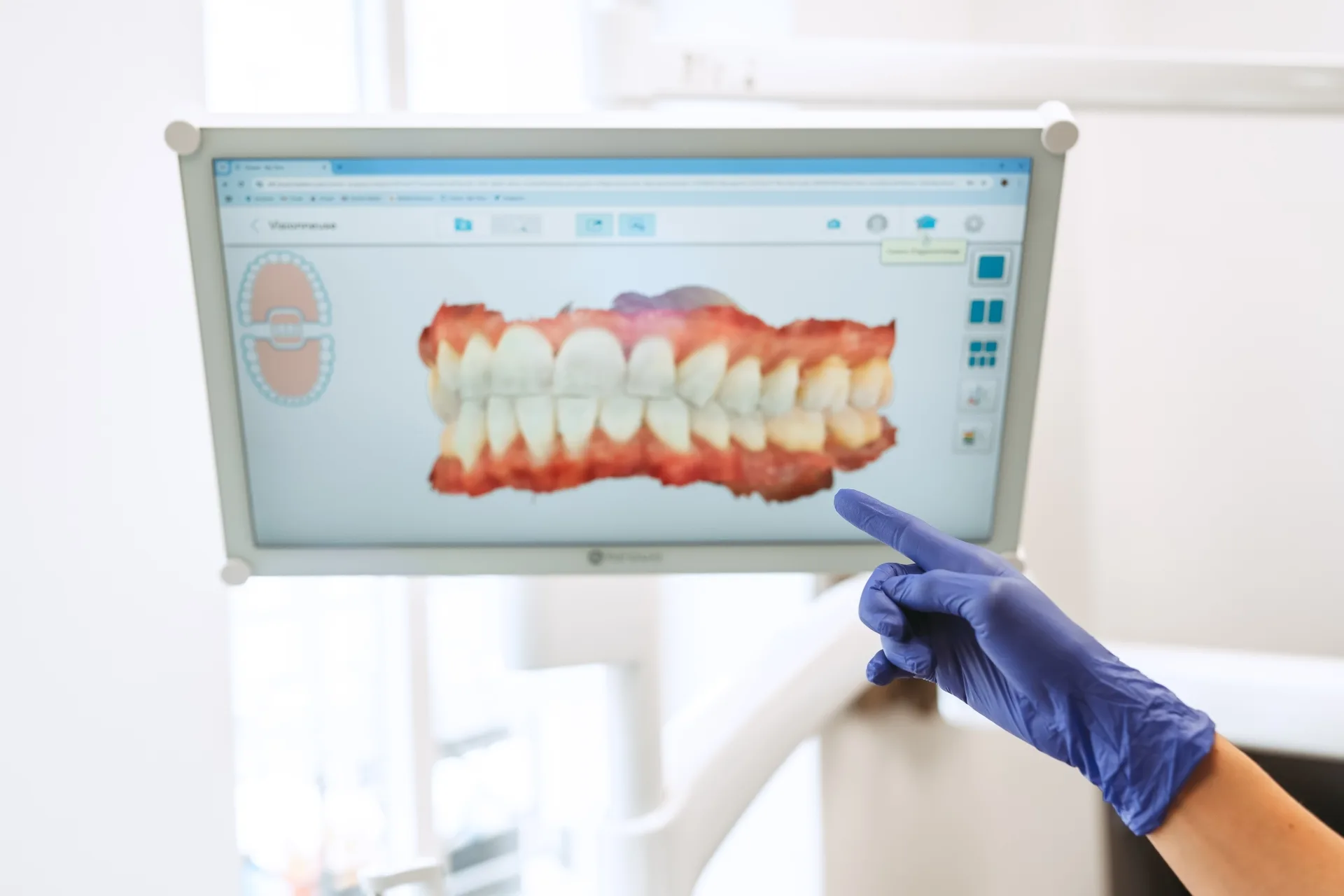 Esthétique du sourire près de Esch-sur-Alzette : maintenir l&rsquo;élégance du sourire